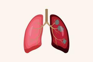 lung cancer and normal lung illustration comparation. eps 10. icon set vector