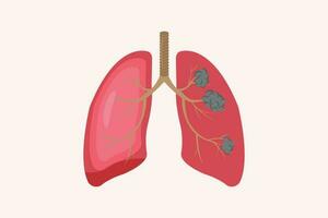 lung cancer and normal lung illustration comparation. eps 10. icon set vector