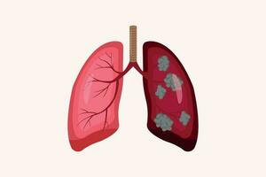 lung cancer and normal lung illustration comparation. eps 10. icon set vector