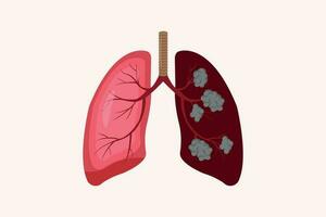 lung cancer and normal lung illustration comparation. eps 10. icon set vector