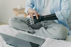 Handicapped woman with artificial arm working on laptop at home. Setting up bionic prosthesis. photo