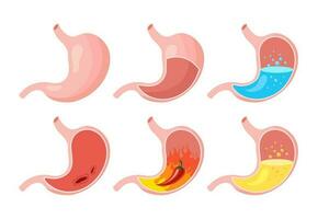 Healthy and unhealthy, empty and full human stomach, icons set. Nutrition, stomach pain, heartburn, heaviness, bloating. Anatomy of the digestive system. vector