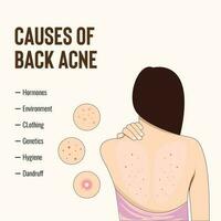 Modern Vector of Exploring the Origins of Back Acne Template Design