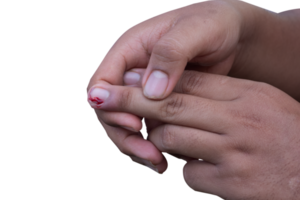 selective focus on bleeding fingers due to ingrown nails. in Indonesian it is called cantengan. paronychia disease. png