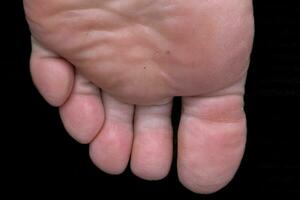 dedos de los pies de un pie de un humano desde abajo foto