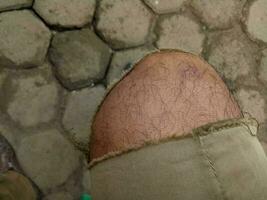 Photo of a boy's leg wearing torn brown trousers against a hexagonal brick floor in the background