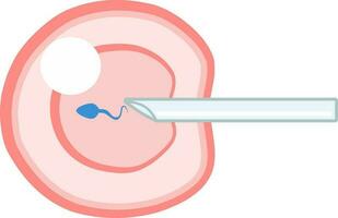 IVF ICSI vector illustration. Perfect for presenting anything about reproduction, insemination or ivf.