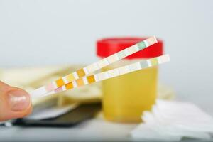 Collection cup with urine test on a table of a lab technician. photo