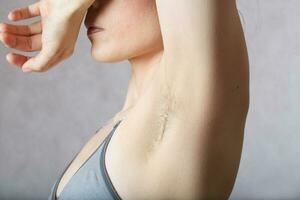 Underarm hair before depilation. Closeup photo