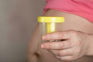 Young pregnant woman keeps empty urine container close to her belly. photo