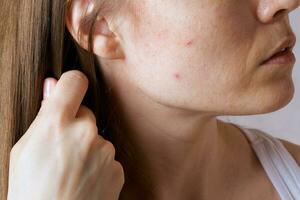 Face skin of young lady between 30 and 35 years old. Closeup photo