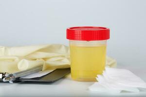 Collection cup with urine test on a table of a lab technician. photo