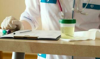 Collection cup of urine specimen. Closeup photo