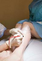 Cosmetologist does needle epilation to her patient. photo