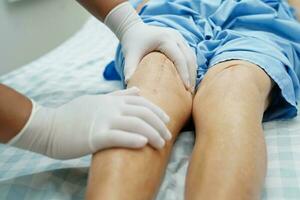 Doctor checking Asian elderly woman patient with scar knee replacement surgery in hospital. photo