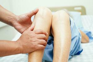 Doctor checking Asian elderly woman patient with scar knee replacement surgery in hospital. photo