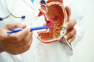 Stomach disease, doctor holding anatomy model for study diagnosis and treatment in hospital. photo