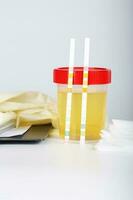 Collection cup with urine test on a table of a lab technician. photo