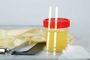 Collection cup with urine test on a table of a lab technician. photo