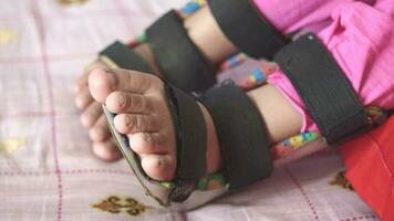 Child cerebral palsy disability, legs orthosis video