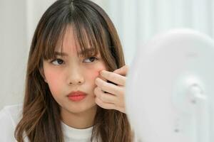 Young woman are worried about faces Dermatology and allergic to steroids in cosmetics. sensitive skin, red face from sunburn, acne, allergic to chemicals, rash on face. skin problems and beauty photo