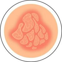 Flat Style Eczema Disease Skin Circle Icon In Red And Peach Color. vector