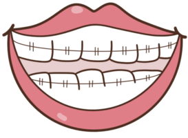 Dentist braces teeth png