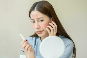 Dermatology, asian young woman looking at mirror, holding cream tube in hand, expression worry and itch, itchy allergy or allergic sensitive reaction, red or rash on face. Beauty care of skin problem photo