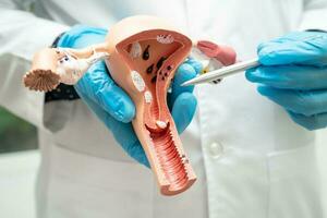 Uterus, doctor holding anatomy model for study diagnosis and treatment in hospital. photo