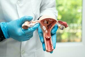 Uterus, doctor holding anatomy model for study diagnosis and treatment in hospital. photo