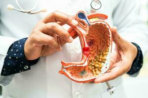 Stomach disease, doctor holding anatomy model for study diagnosis and treatment in hospital. photo