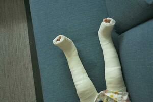 pequeño niño con yeso vendaje en pierna. foto