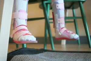 Child cerebral palsy disability, legs orthosis. photo