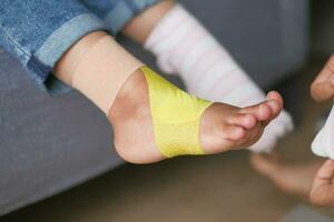 little child with plaster bandage on leg. photo