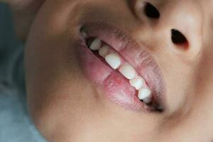 close up of white teeth of a child , photo