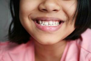 child smiling with healthy white teeth. photo