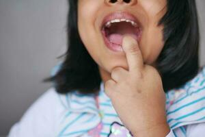 detalle Disparo de niño con dientes desaparecido foto