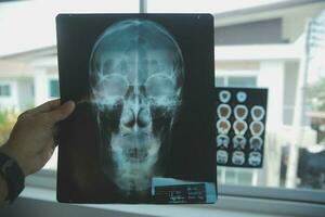 Doctors discussing over medical x-ray in clinic photo