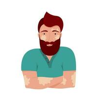 retrato de un hombre con vitíligo. masculino avatar rostro. mundo vitiligo día. el concepto de todas tipos de belleza y cuerpo positividad piel enfermedad. aceptar y amor tú mismo. vector ilustración