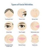 Types of facial wrinkles vector icon set on white background. Icon set of Forehead, Bunny, Marionette, Frown lines, Mental crease, Crows feet, Tear troughs, Nasolabial folds, Smile and Neck lines.