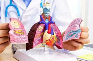 Close up of anatomical model of human lungs. photo