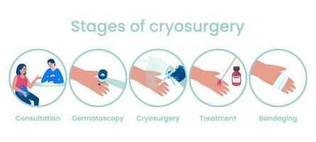 Stages of the cryosurgery procedure in the treatment of skin neoplasms vector