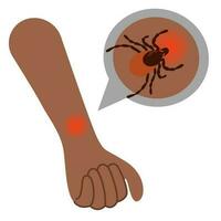 The human hand with the tick bite. Tick bite hand.Tick bite. Healthcare illustration. vector