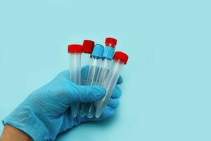 empty test tubes in the hand of a medic in a glove on a blue background photo