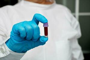 doctor holding a test tube with blood photo