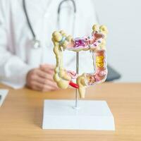 Doctor with human Colon anatomy model. Colonic disease, Large Intestine, Colorectal cancer, Ulcerative colitis, Diverticulitis, Irritable bowel syndrome, Digestive system and Health concept photo