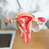 Doctor with Uterus and Ovaries anatomy model. Ovarian and Cervical cancer, Cervix disorder, Endometriosis, Hysterectomy, Uterine fibroids, Reproductive system, Pregnancy and health concept photo