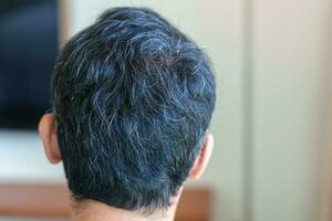 hombre asiático con cabello gris y blanco creciendo. concepto de problema de cabello foto