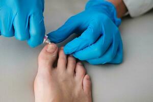 A doctor in medical gloves smears ointment on a sore finger photo