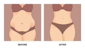 barriga gordo. antes de y después peso pérdida, mujer cuerpo forma transformación, grasa a adaptar. vector